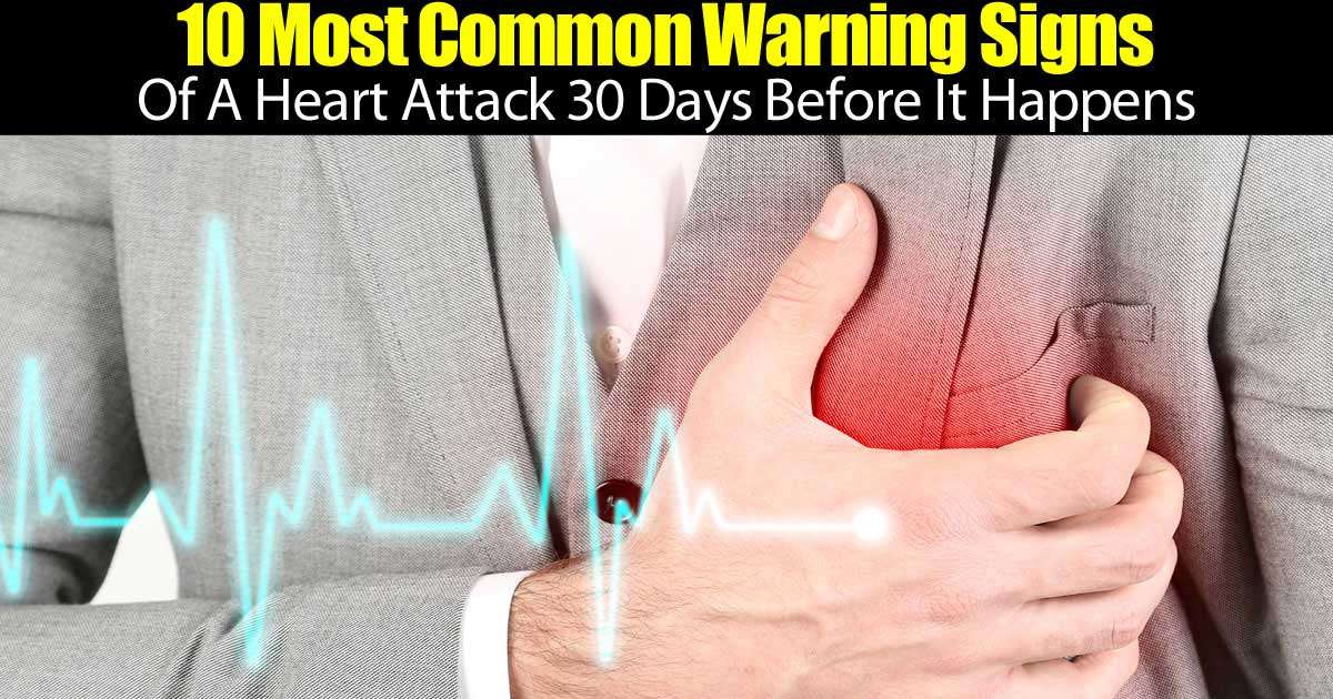 10 Most Common Warning Signs Of A Heart Attack 30 Days ...