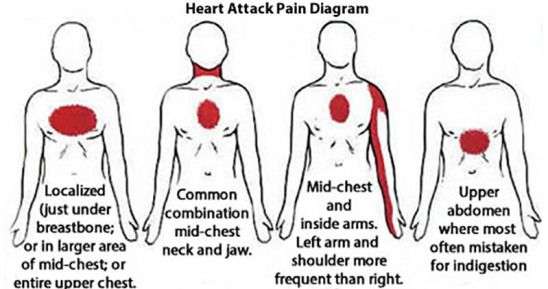 10 Of The Most Common Signs 30 Days Before A Heart Attack ...