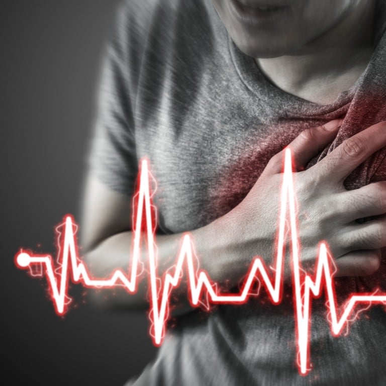 10 things about heart attacks that could mean difference between life ...
