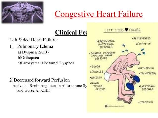 15. Congestive Heart Failure Clinical Features Left Sided ...