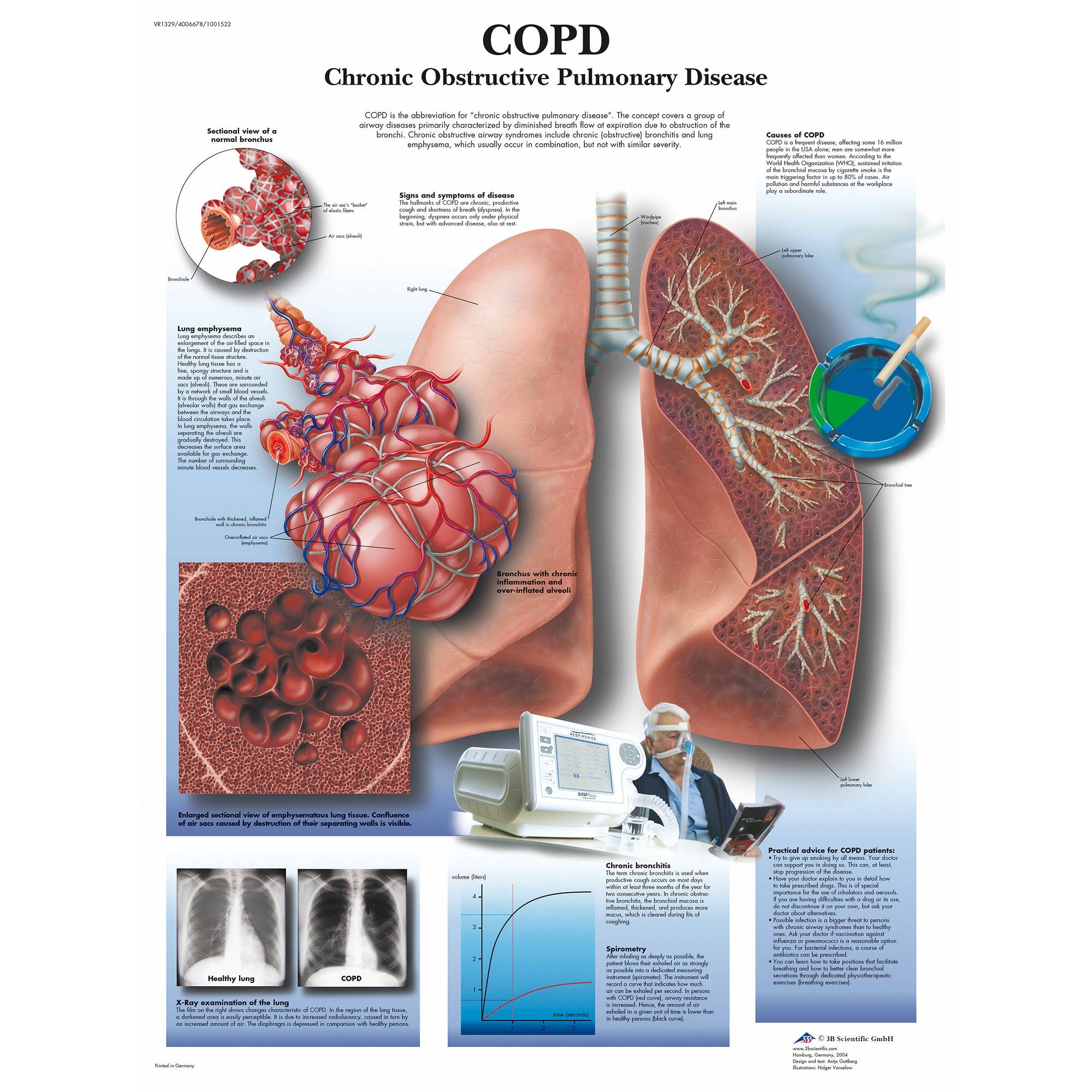 3B Scientific COPD Chart