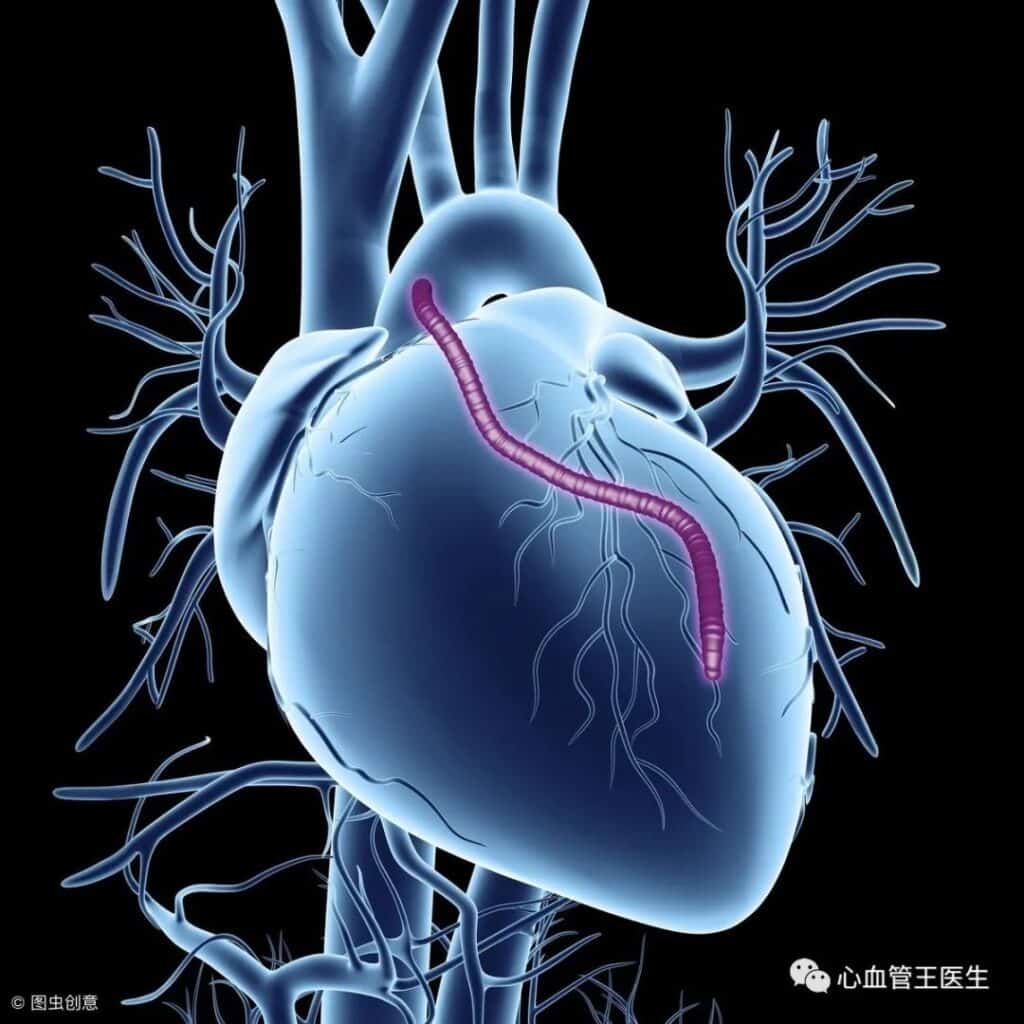 6 most common heart surgeries
