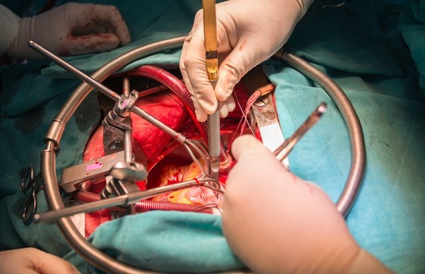 7 of the most dangerous surgeries