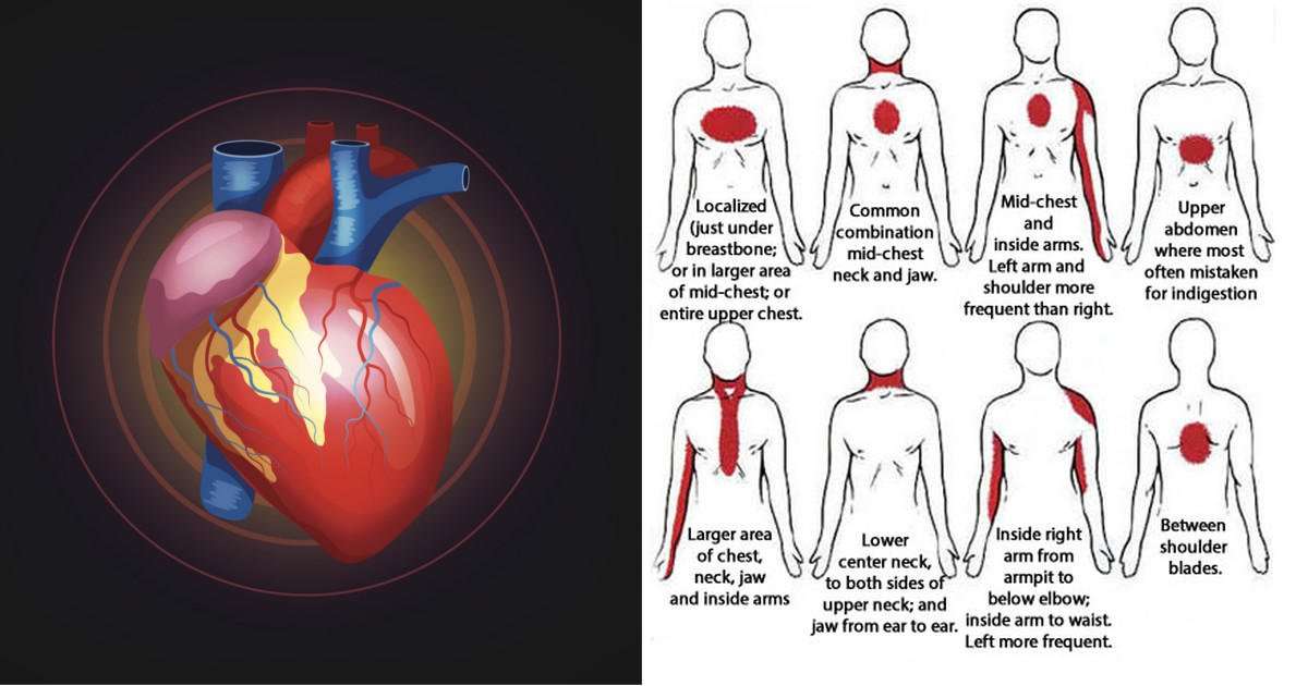 7 Warning Signs of An Imminent Heart Attack That Women ...