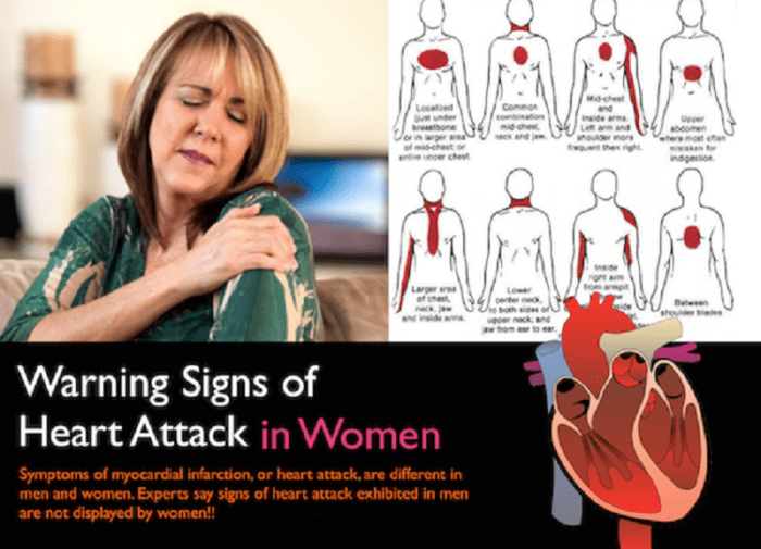 7 Warning Signs of Heart Attack In Women : Human N Health