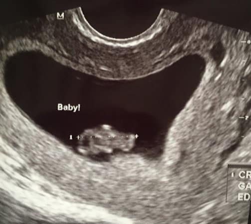 8 week ultrasound! Share?