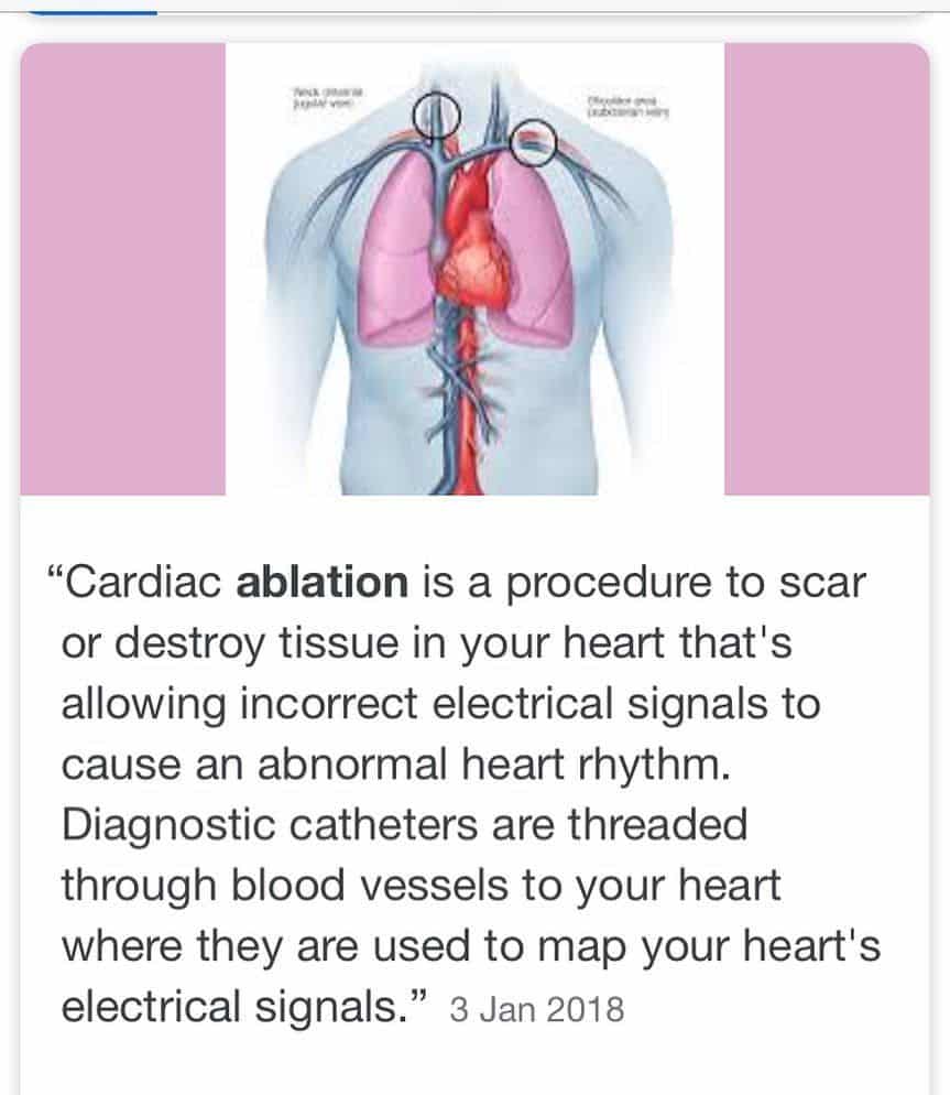 A few people have asked about what an ablation actually is. Also People ...