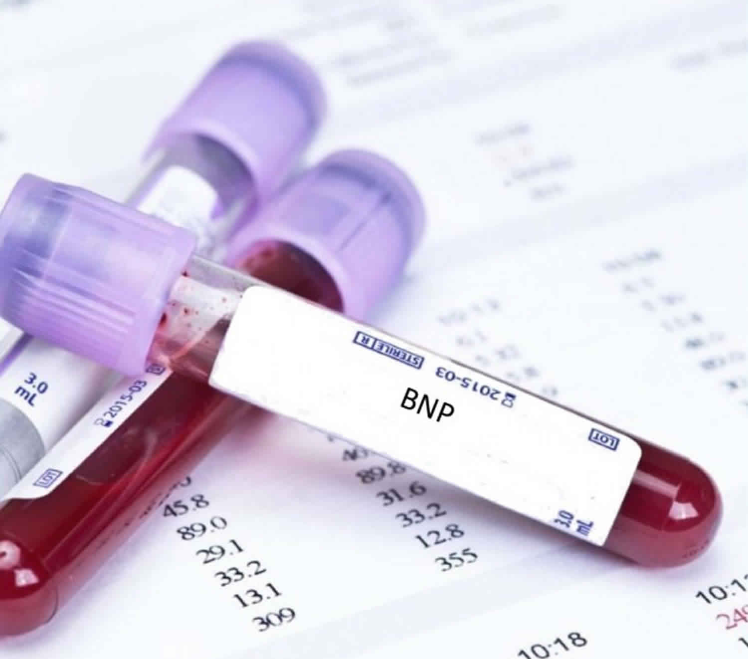 BNP blood test uses, BNP blood test normal range &  BNP for heart failure
