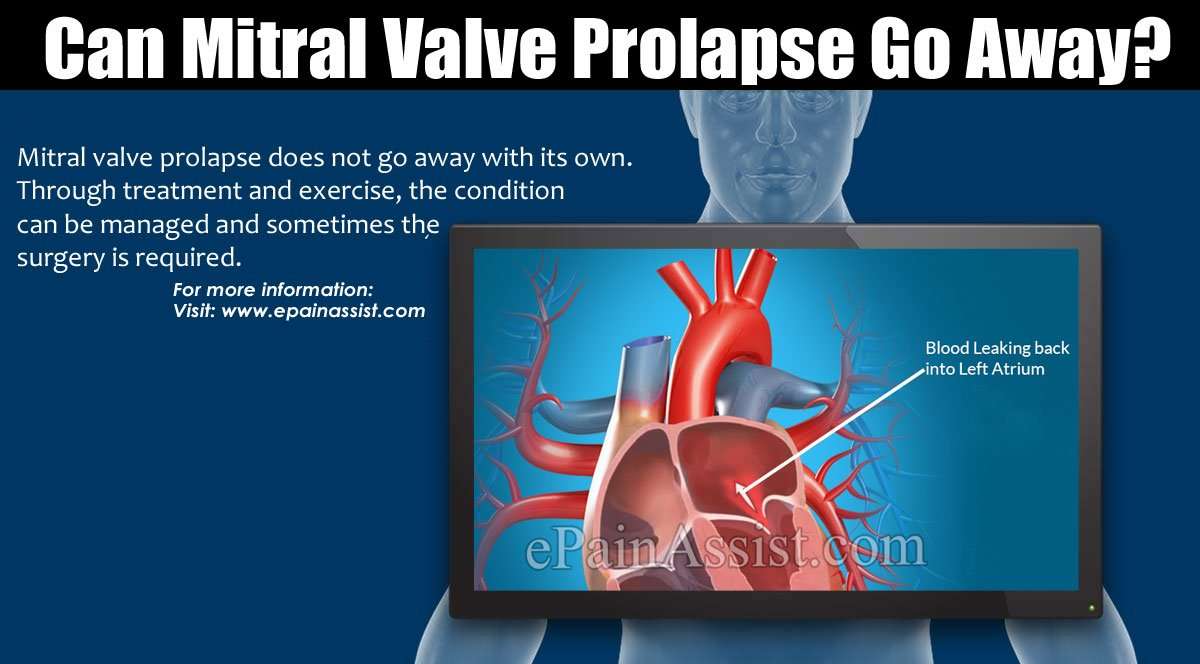 Can Mitral Valve Prolapse Go Away?