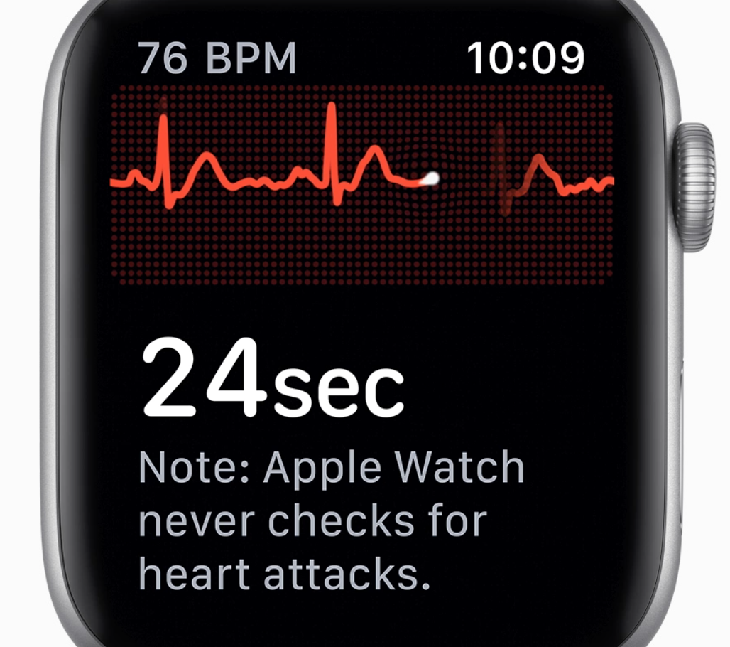 Can The Apple Watch Or Kardia ECG Monitor Detect Heart ...