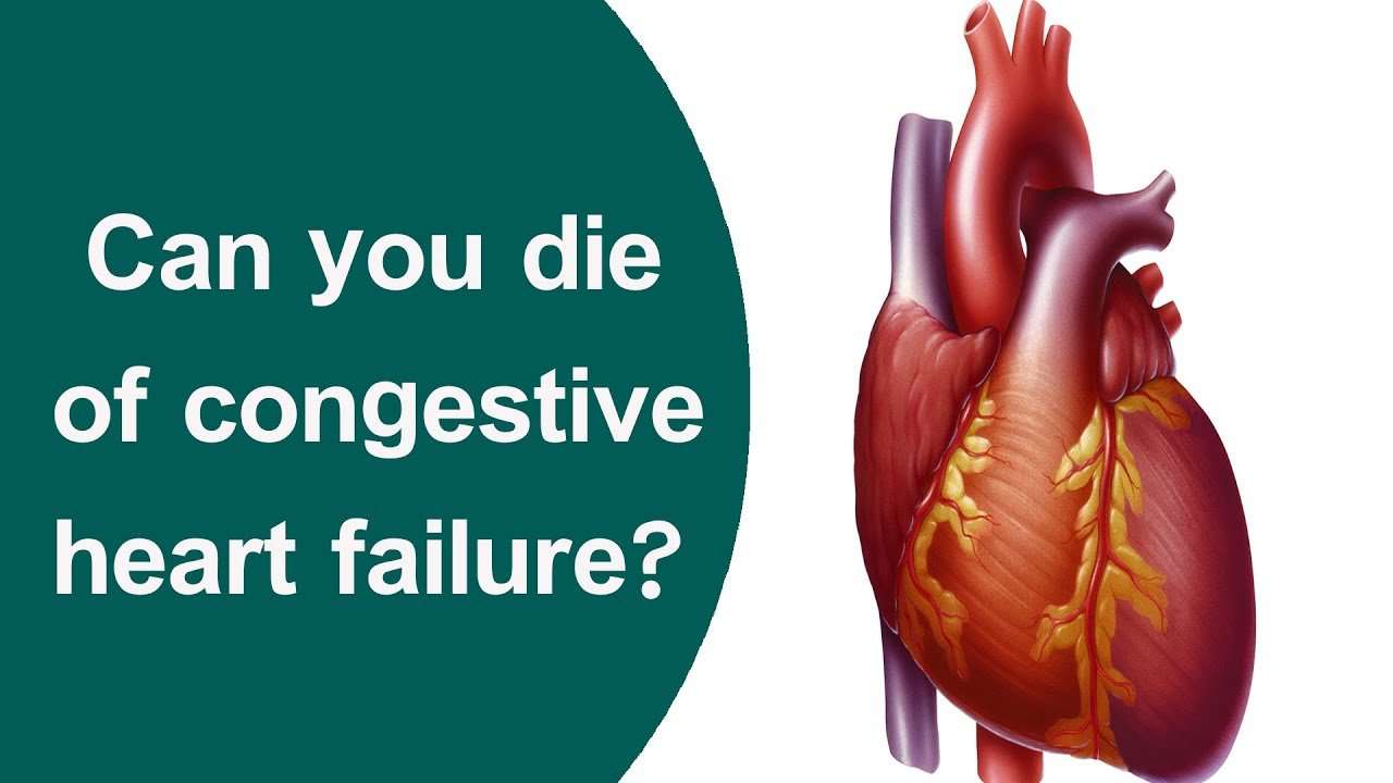 Can you die of congestive heart failure?