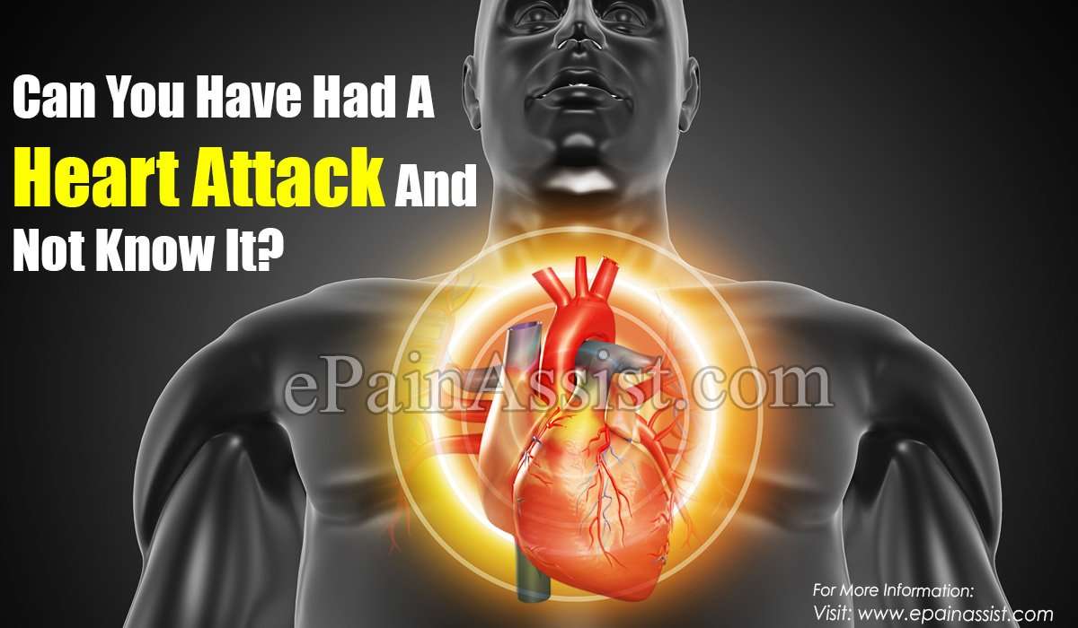 Can You Have Had A Heart Attack And Not Know It?