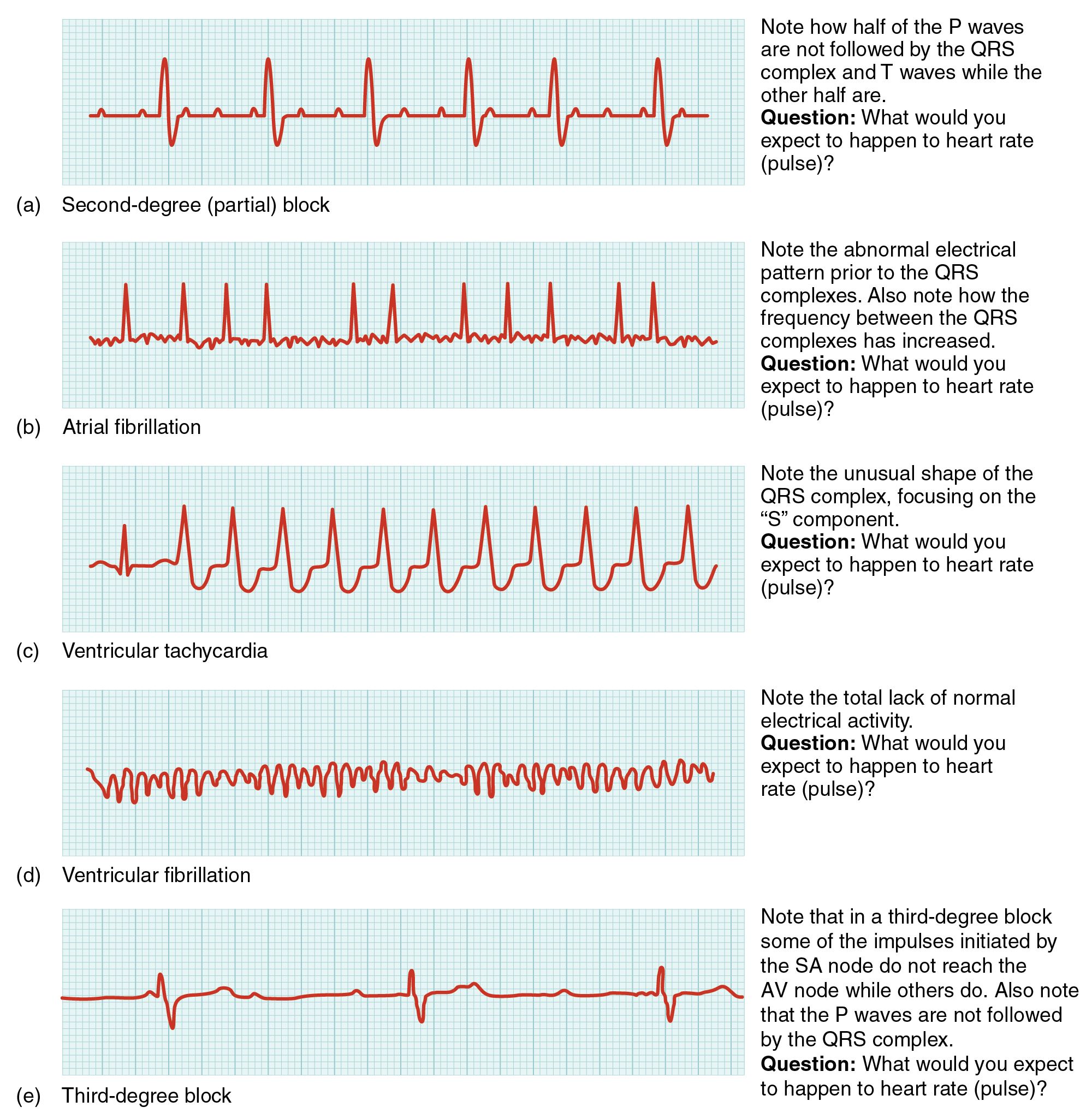 Cardiac Muscle and Electrical Activity