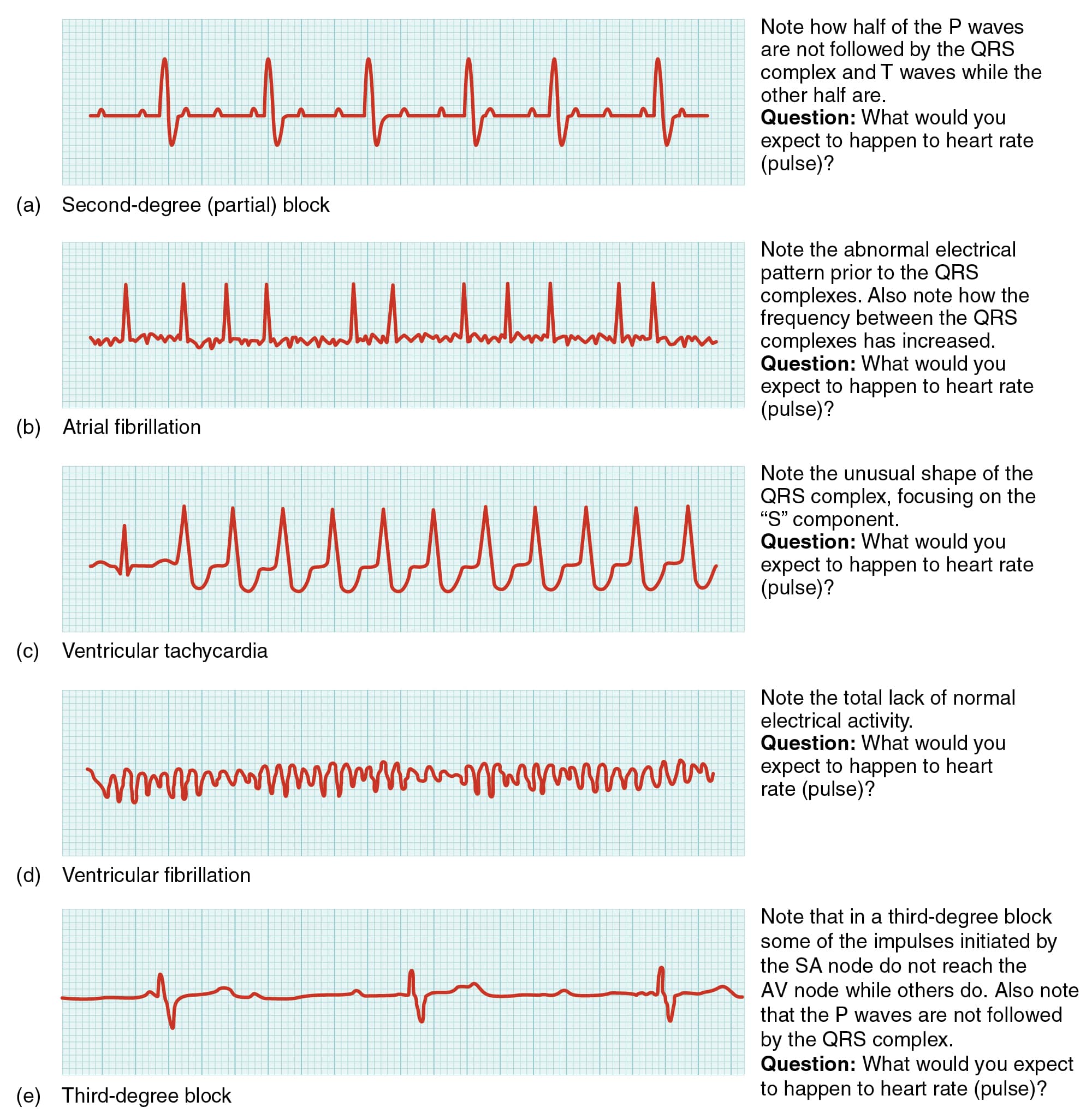 Cardiovascular System  Heart  Building a Medical Terminology Foundation