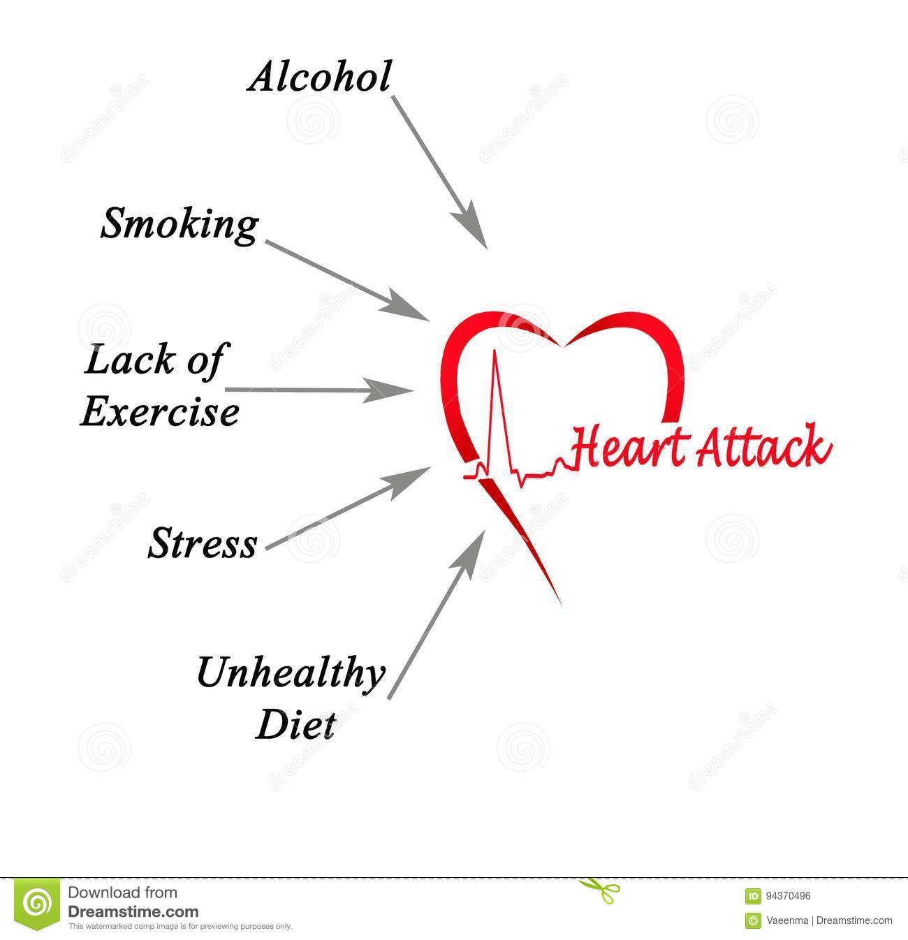 Causes of heart attack stock illustration. Illustration of medicine ...