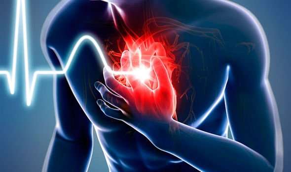 Chest pain: Heart attack symptoms include shortness of ...