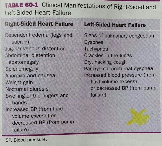 Clinical manifestations of Right