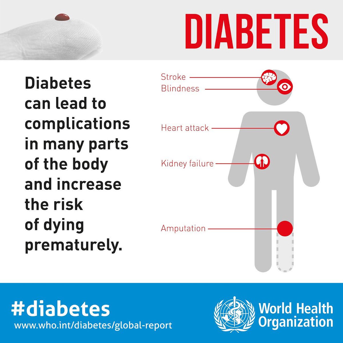 : Complications of #diabetes can lead to: