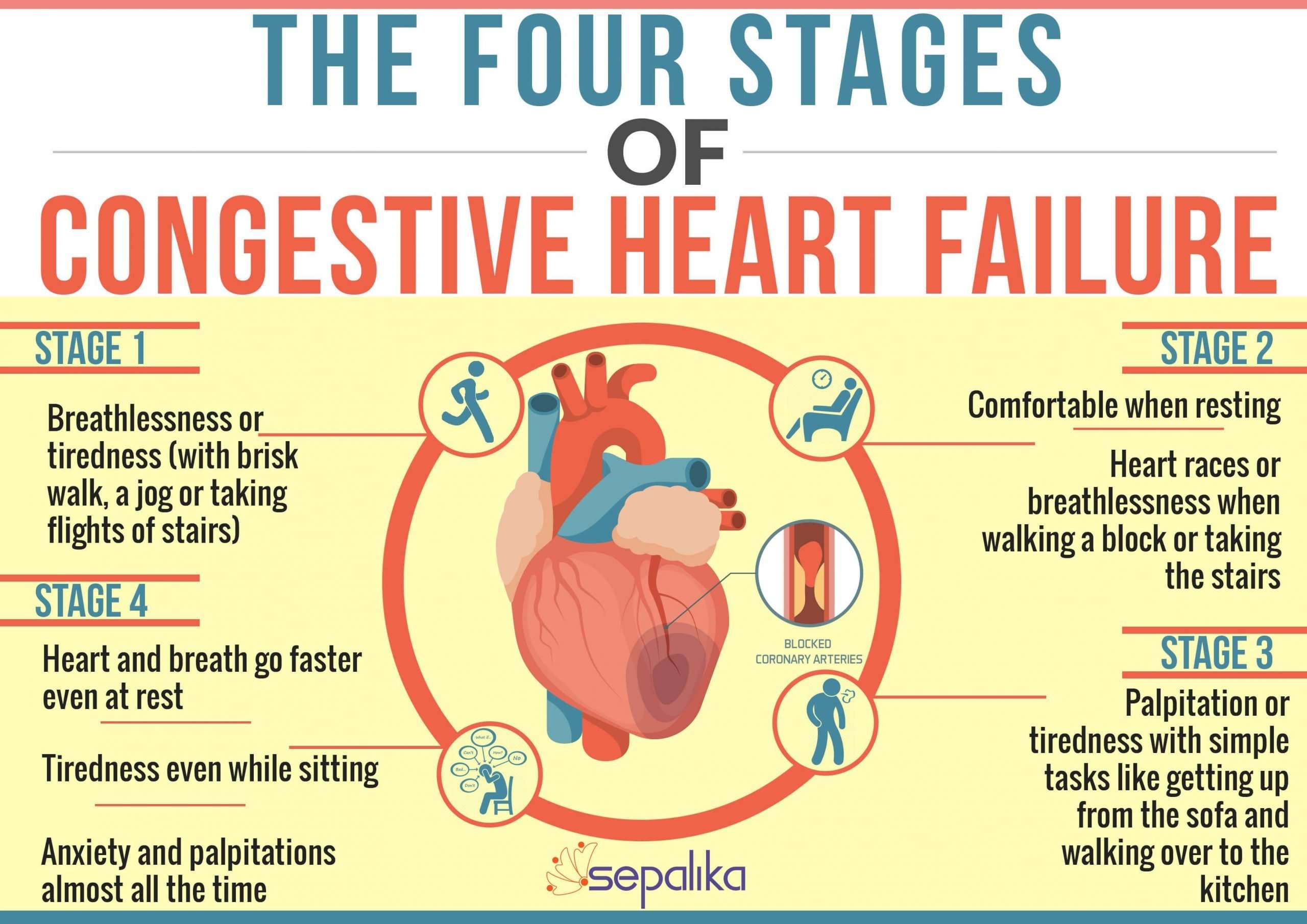 Congestive Heart Failure (CHF): Symptoms, Stages, Life ...