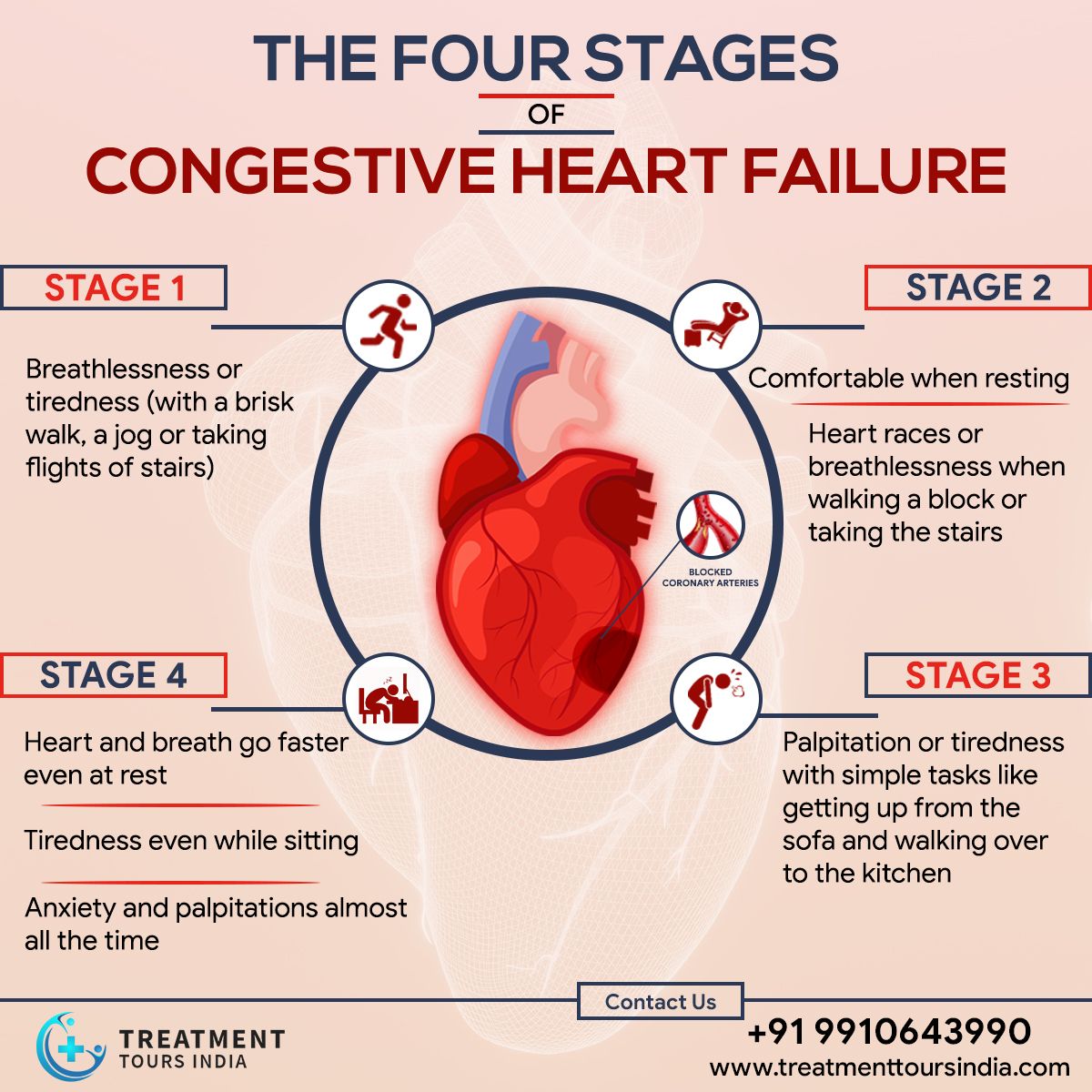 Congestive Heart Failure doesnât happen in a day  it takes many months ...