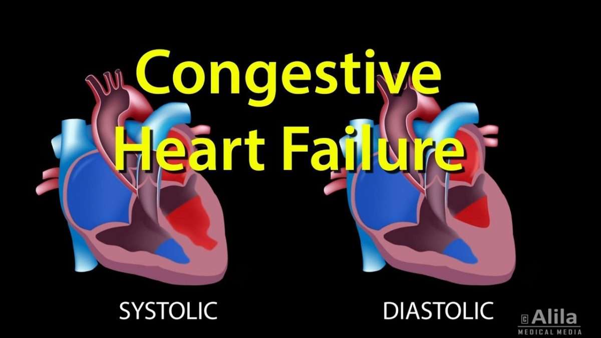 Congestive Heart Failure: Left