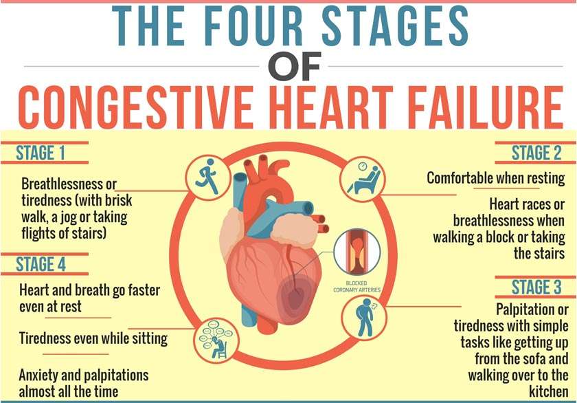 Congestive Heart Failure Symptoms &  Life Expectancy