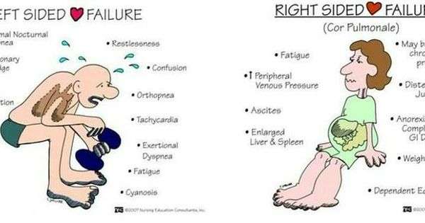 difference between left and right sided heart failure symptoms