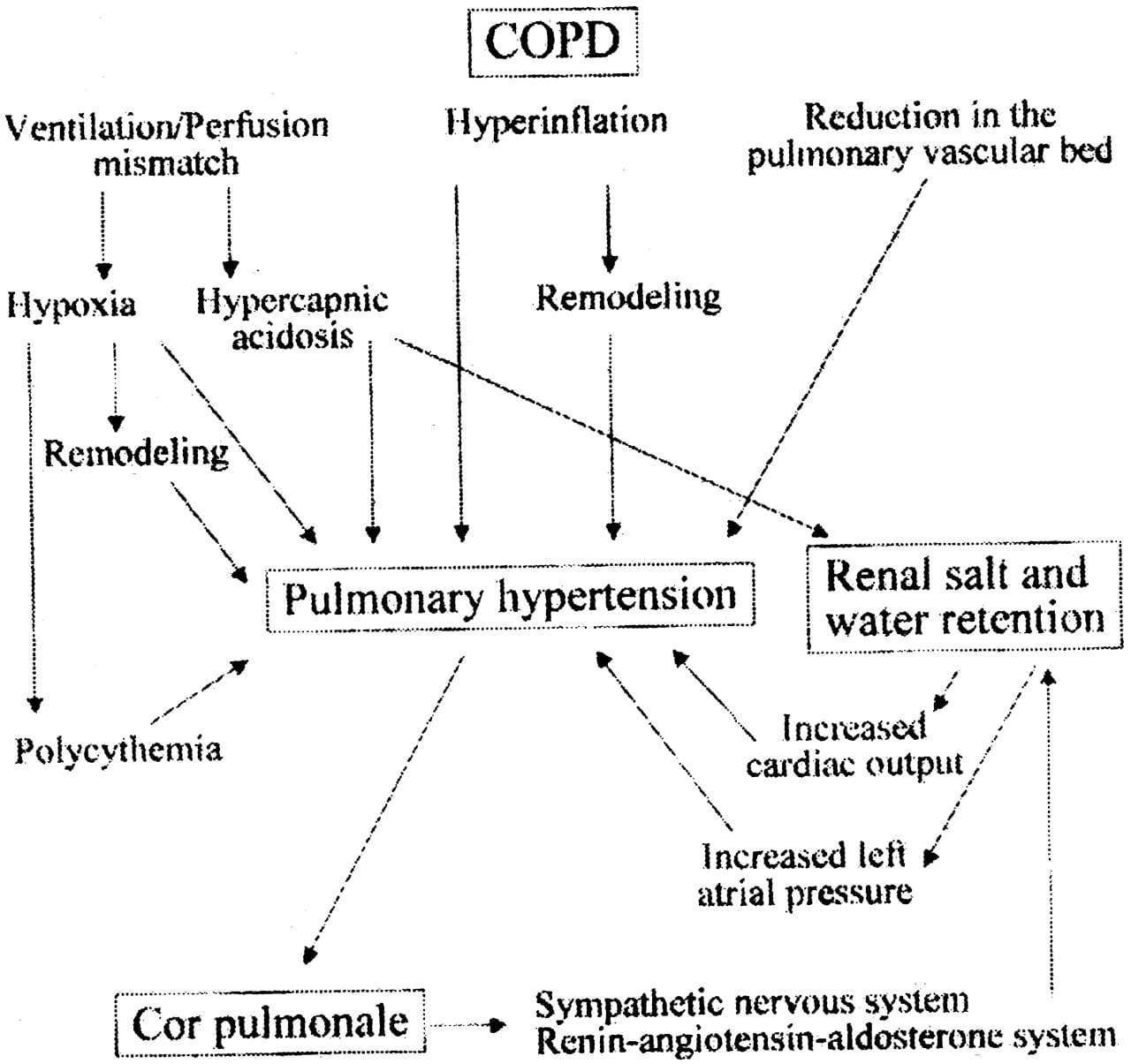 Doctors Gates: RIGHT VENTRICULAR FAILURE IN COPD