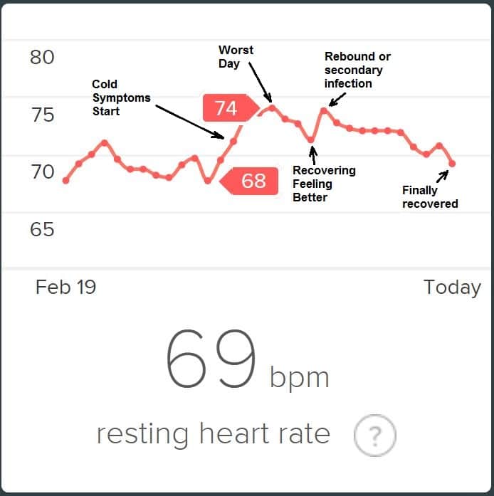 Does Heart Rate Increase During Sleep