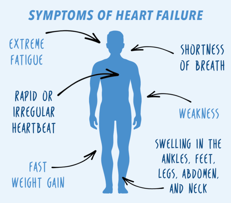 Early symptoms of heart disease * Synergy Heart &  Health