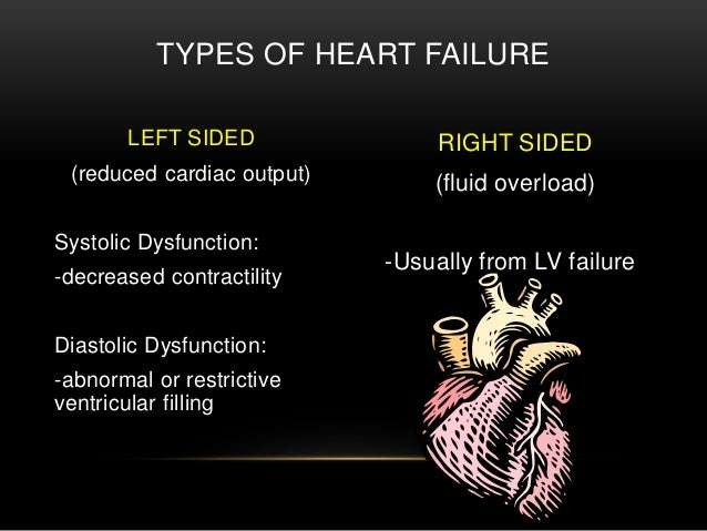 End Stage Heart Failure in Hospice