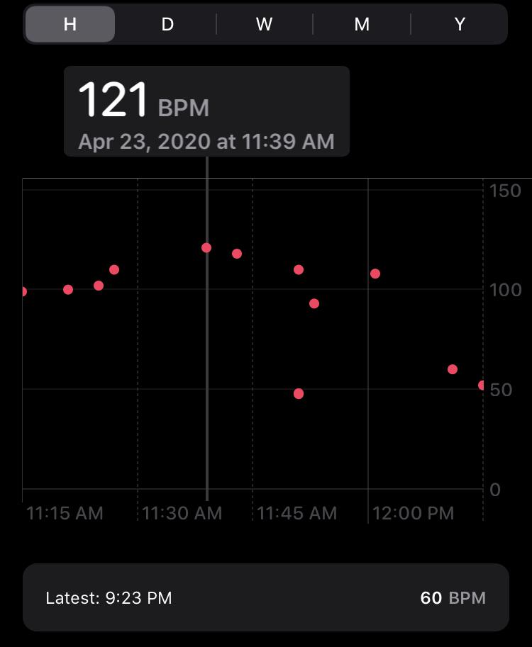 Faulty data or something serious? Apple Watch says heart rate spikes to ...