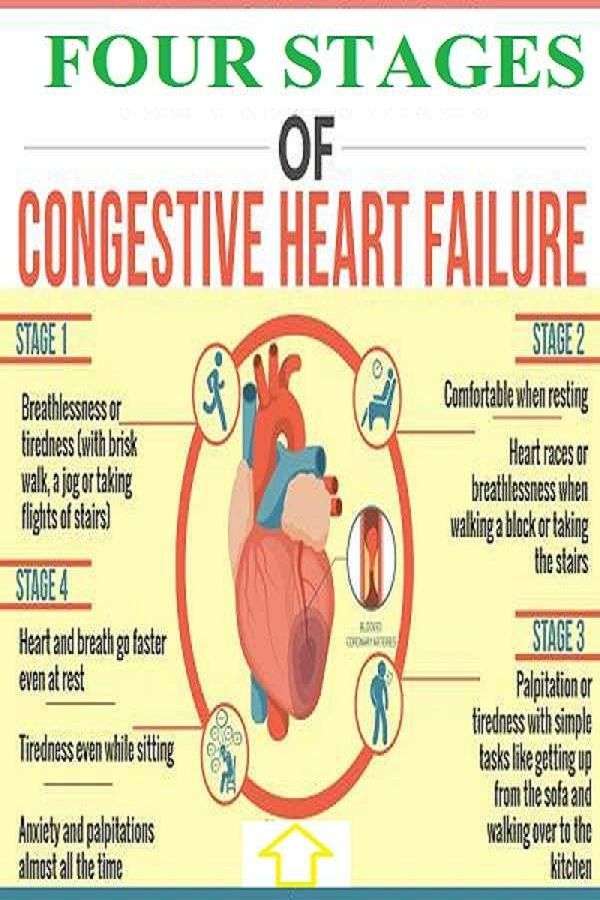 Four Stages of Heart Failure
