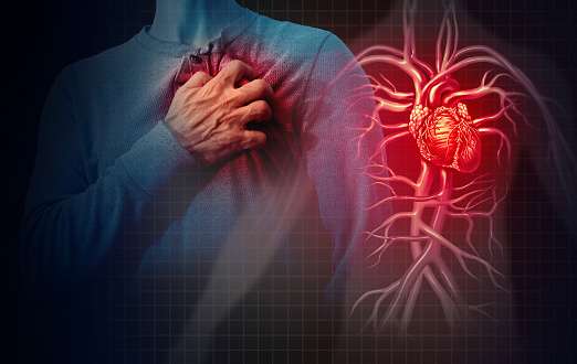 Heart Attack Concept Stock Photo