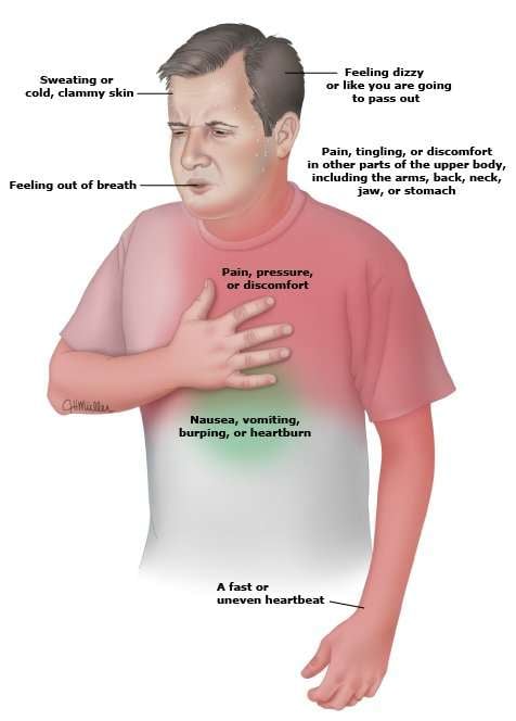 Heart attack symptoms PI