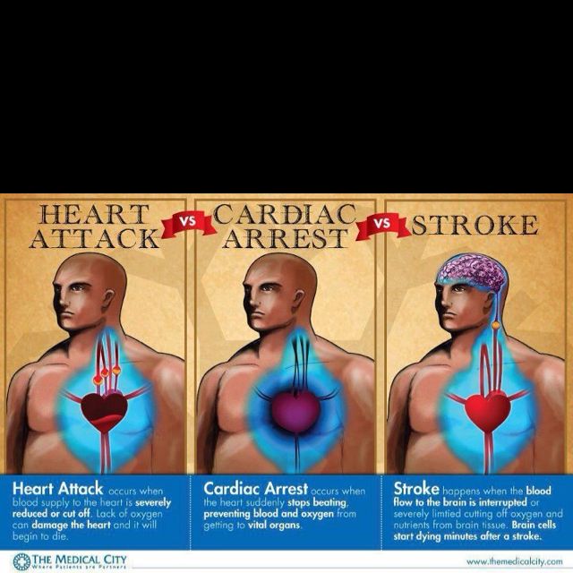 Heart attack vs. Cardiac arrest vs. Stroke