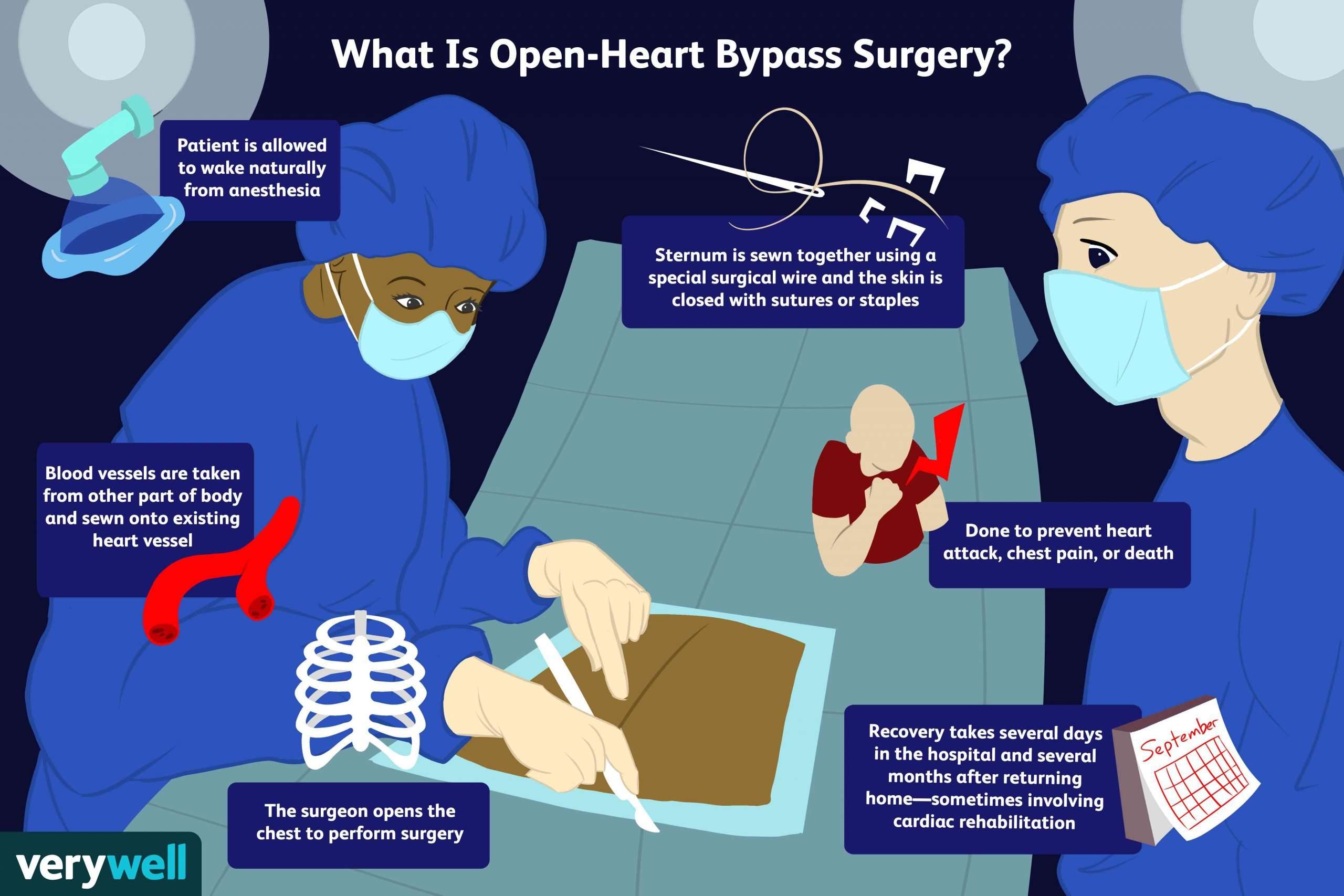 Heart Bypass Surgery: Preparation, Recovery, Long