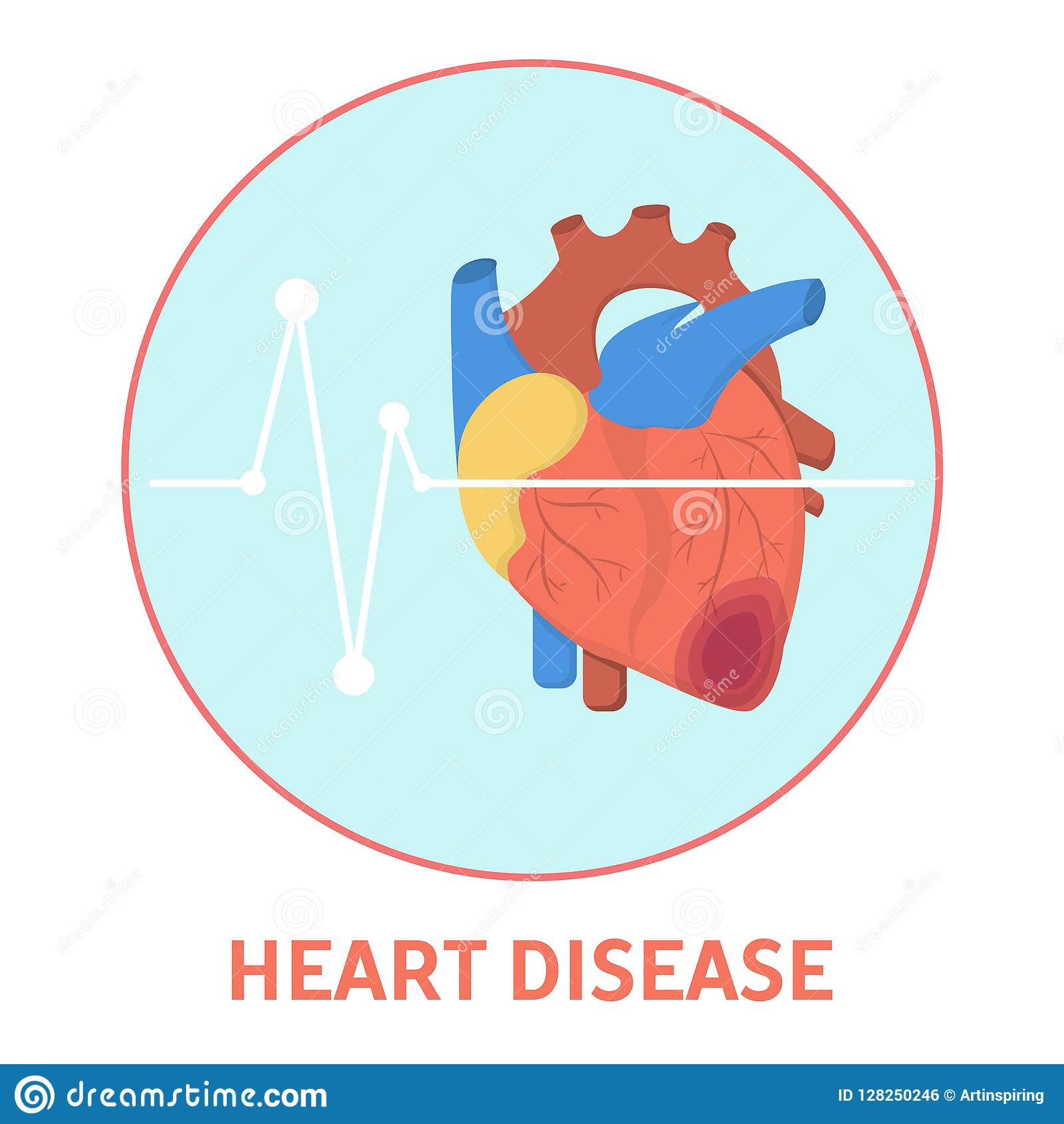 Heart Disease. Problems with Health and Blood Pressure. Stock Vector ...