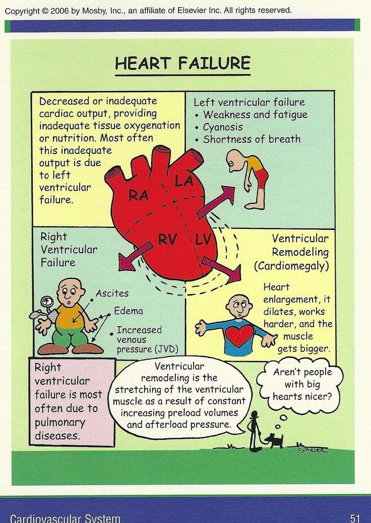 Heart Failure: What Is Left Sided Heart Failure