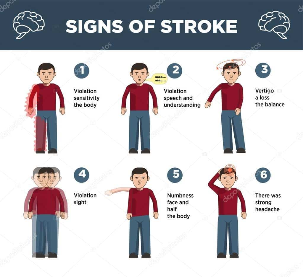 Heart stroke symptoms infographics icons â Stock Vector Â© Sonulkaster ...