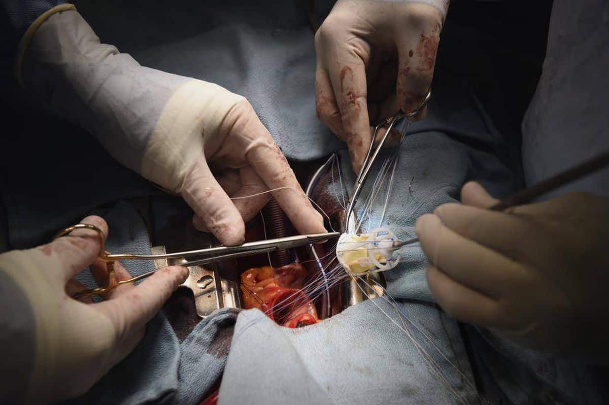 Heart surgery can increase depression risk