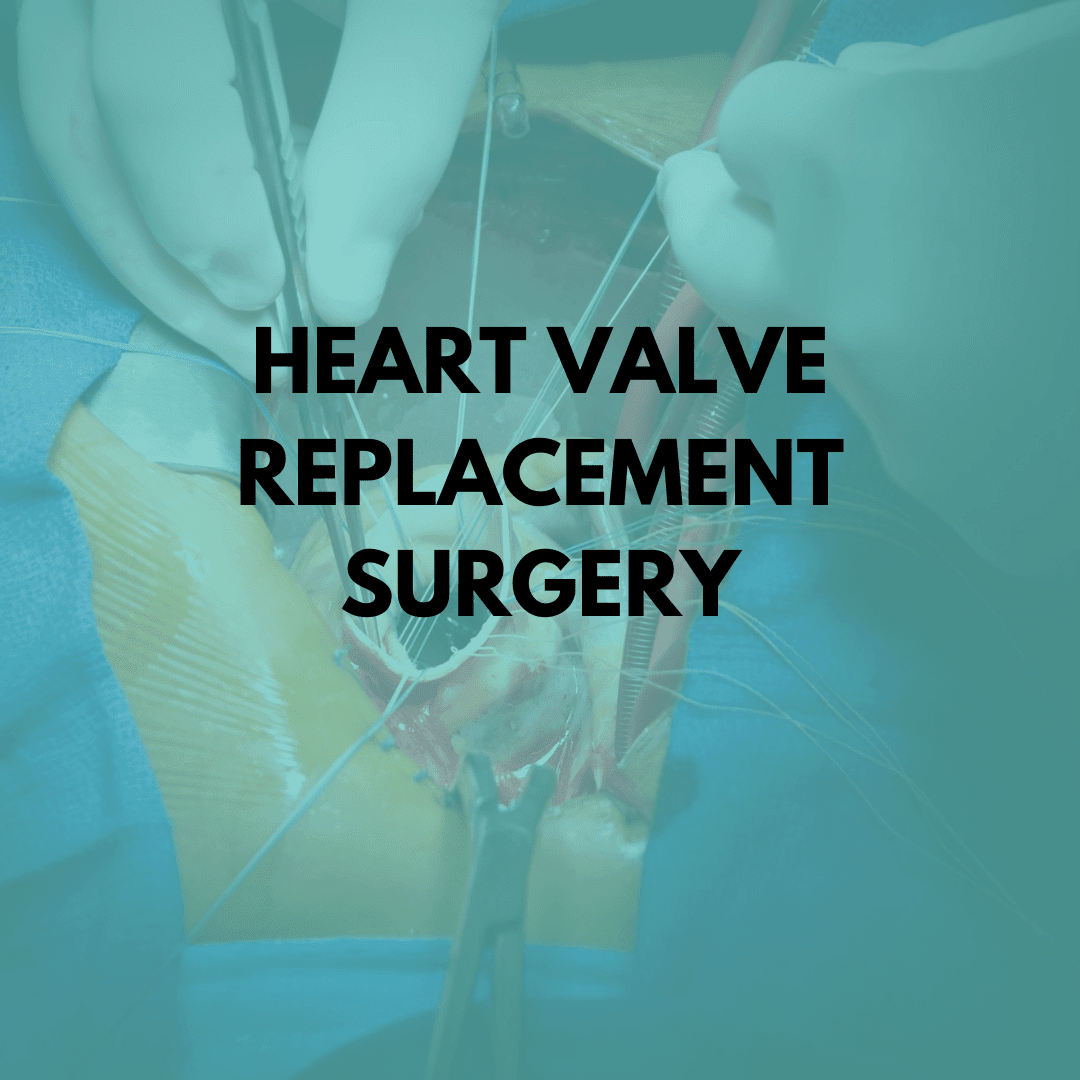 heart valve surgery why is it performed niruja healthtech