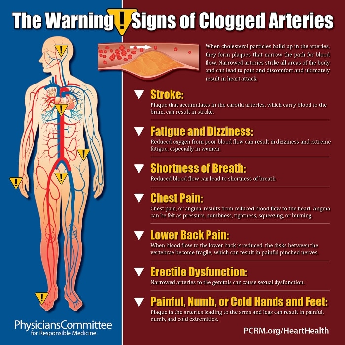 Here Are Some Warning Signs And Symptoms Of Blocked Arteries And ...