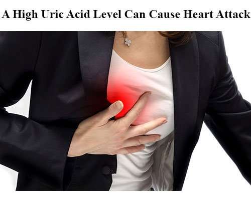 High Uric Acid Levels Can Lead to Heart Attack