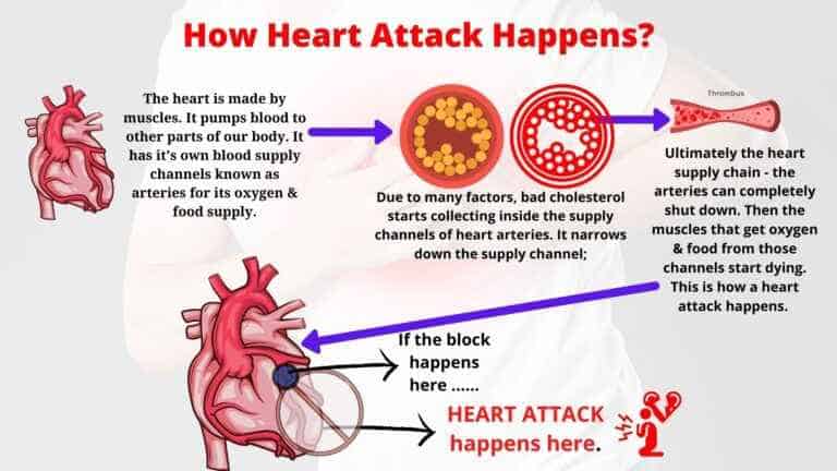 How heart attack happens?