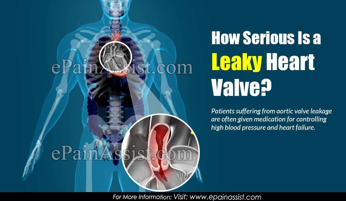 How Serious Is a Leaky Heart Valve?