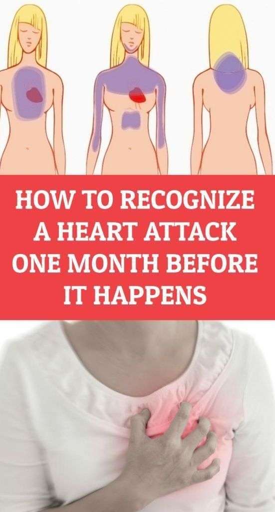How To Recognize A Heart Attack One Month Before It ...