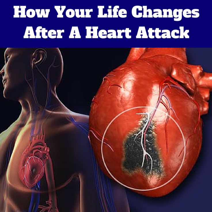 How Your Life Changes After A Heart Attack