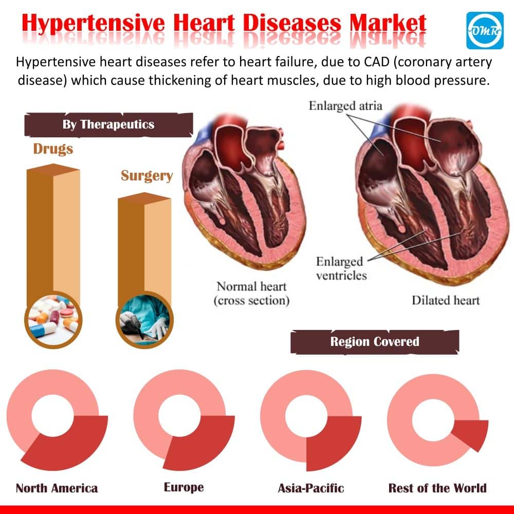 Hypertensive Heart Disease Vs Cad