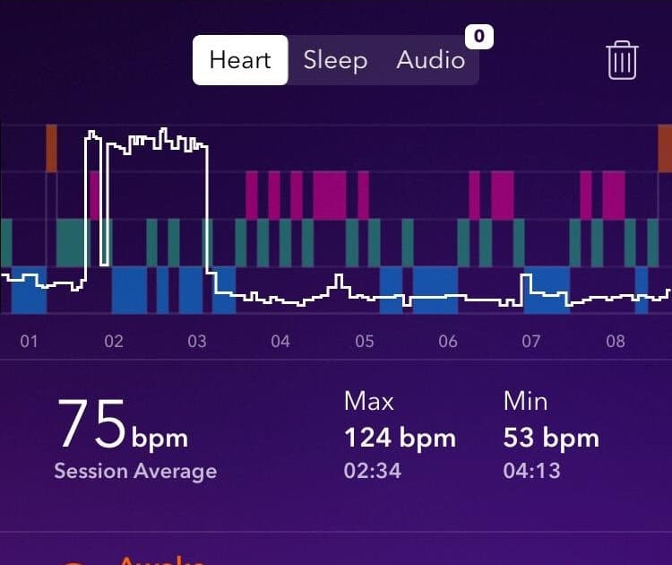 Is A Resting Heart Rate Of 120 Bad